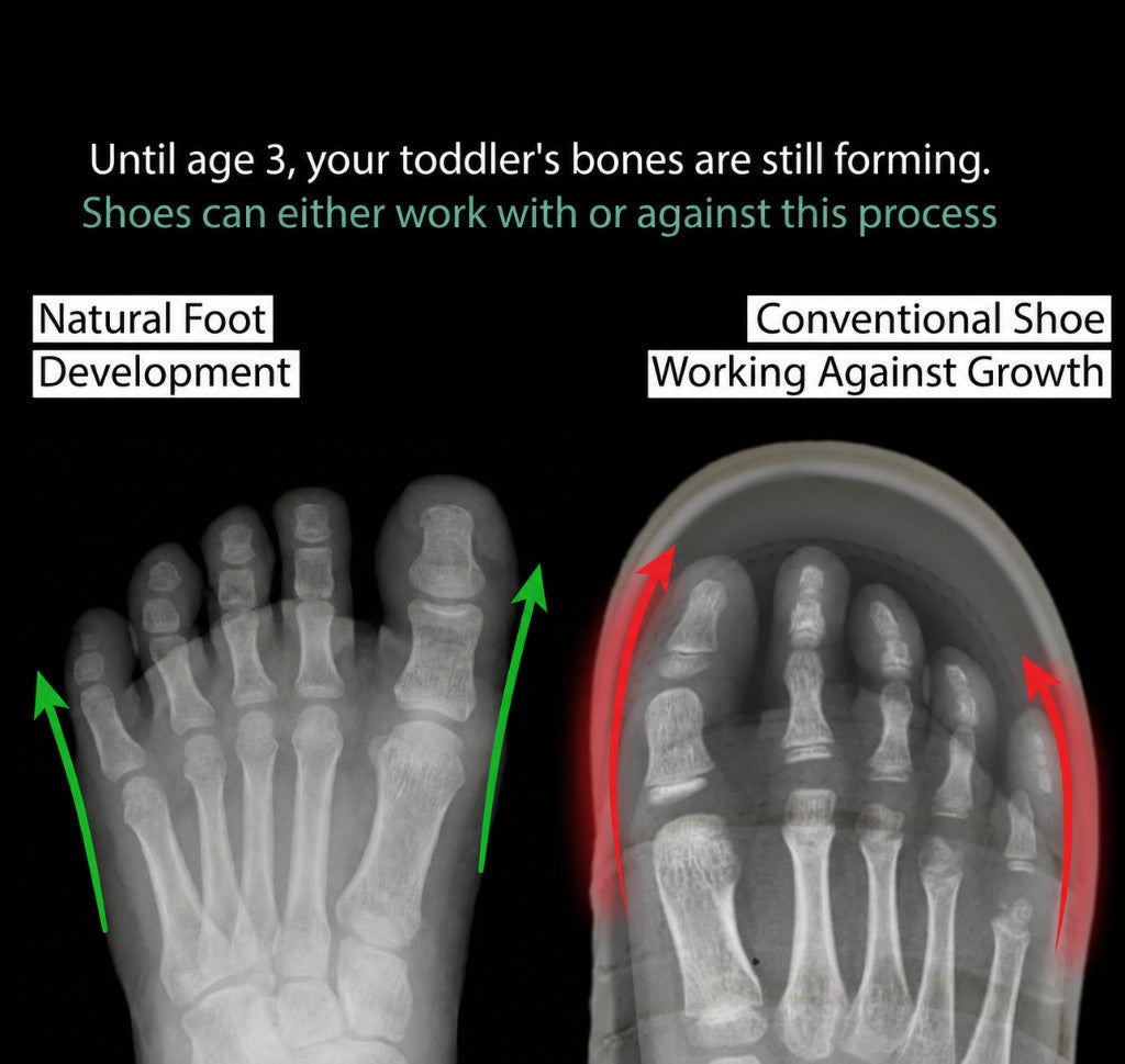 Natural foot development compared with conventional shoes